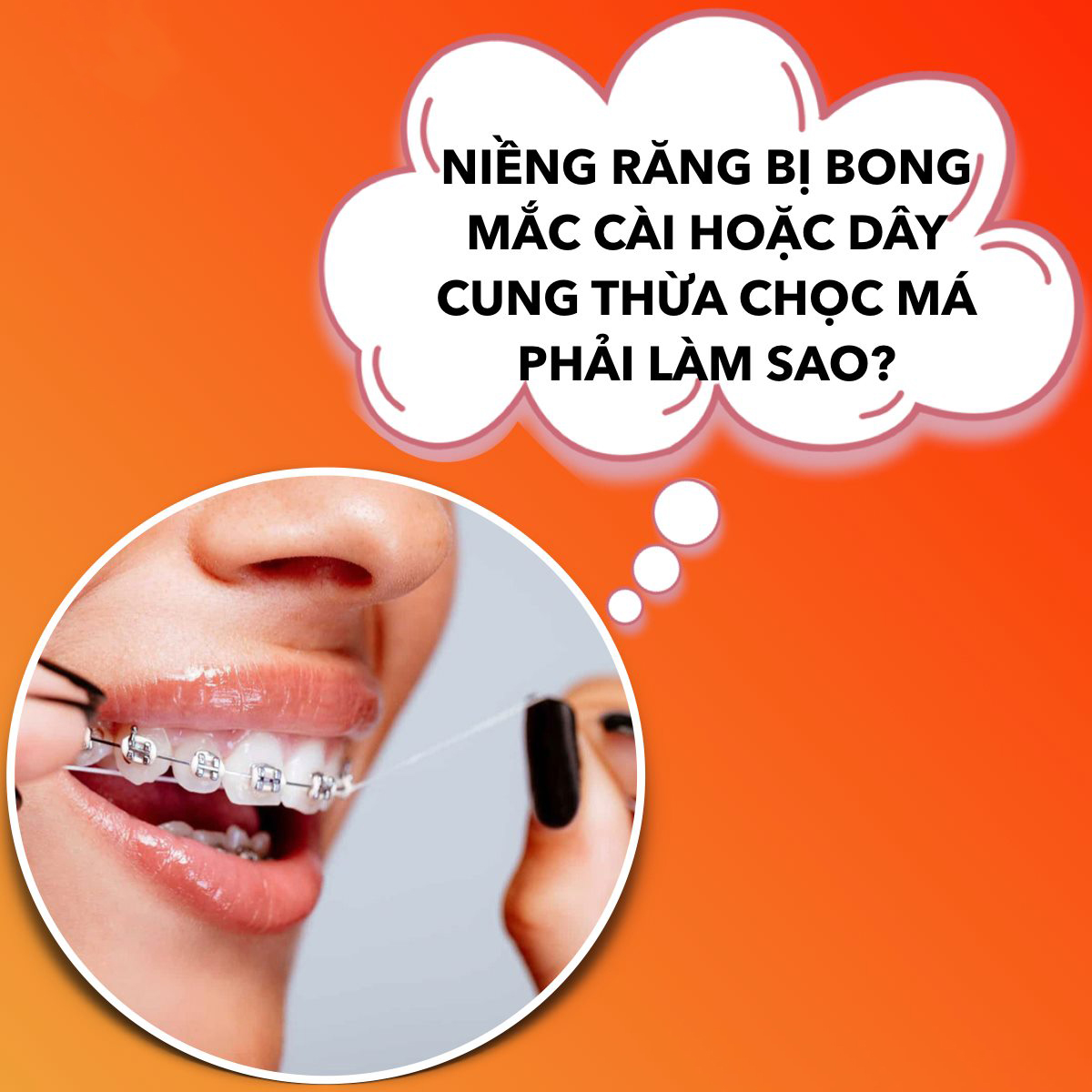 NIỀNG RĂNG BỊ BONG MẮC CÀI HOẶC DÂY CUNG THỪA CHỌC MÁ KHẮC PHỤC NHƯ THẾ NÀO?