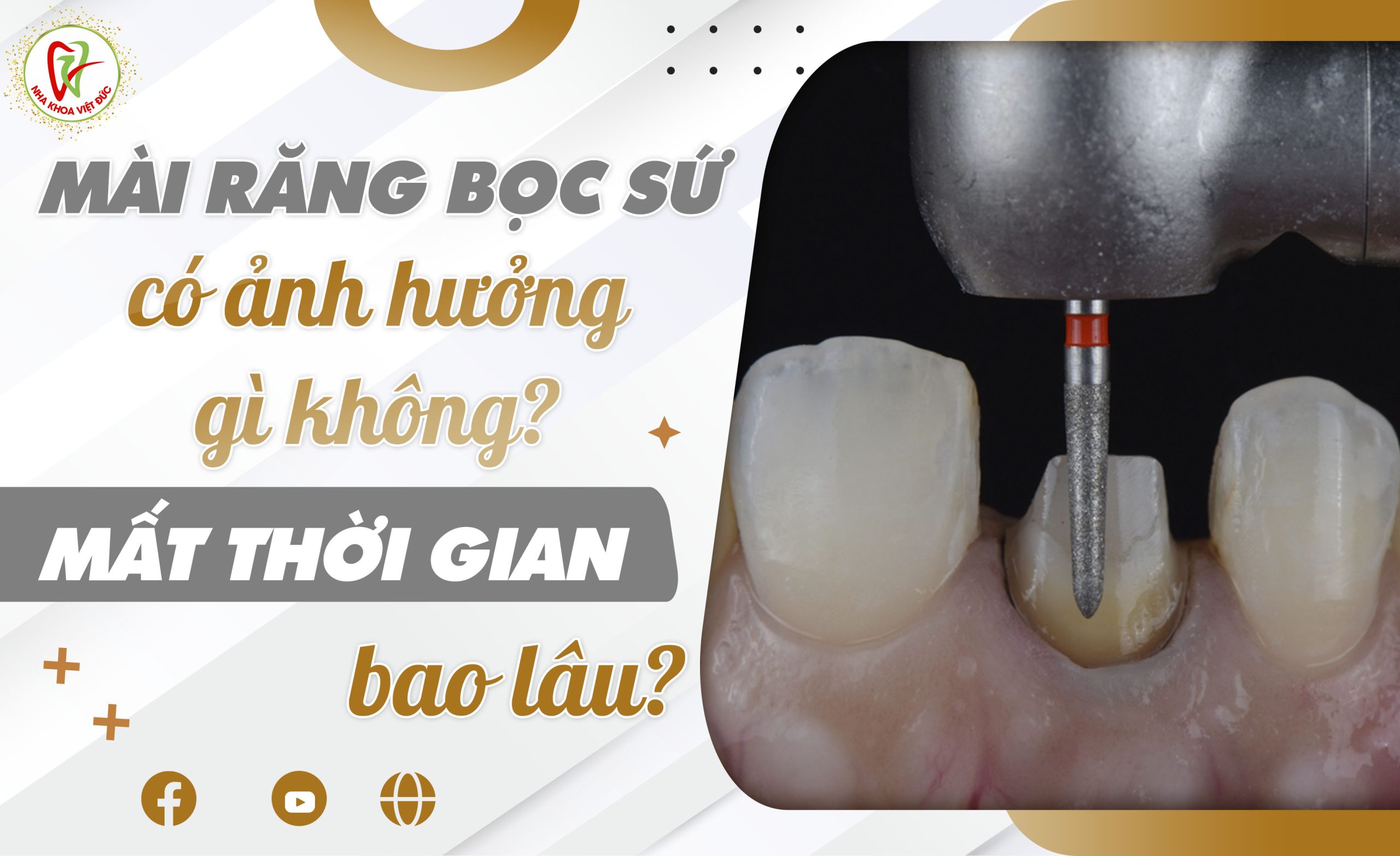 MÀI RĂNG BỌC SỨ CÓ ẢNH HƯỞNG GÌ KHÔNG? MẤT THỜI GIAN BAO LÂU?